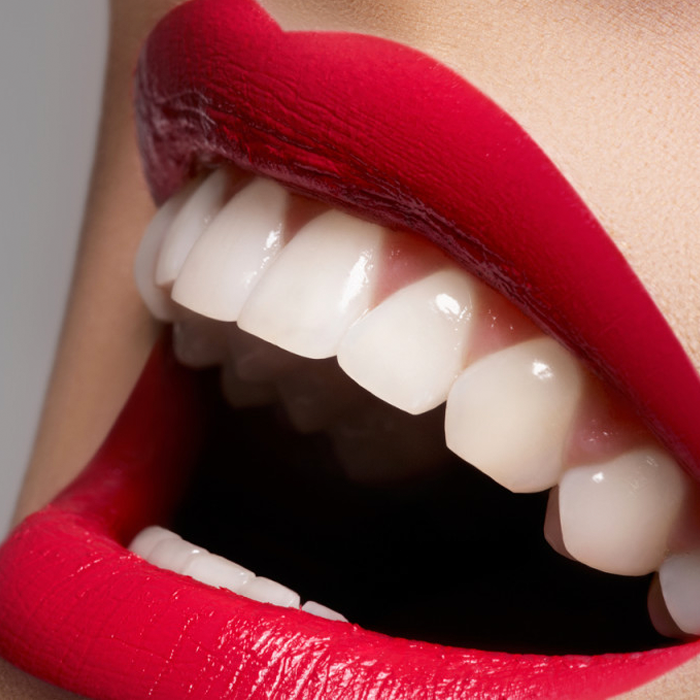 Estética dental Efecto Smile